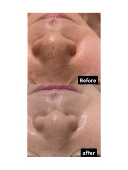 ディサイドロー(DECIDE L.A.W)/BeforeAfter