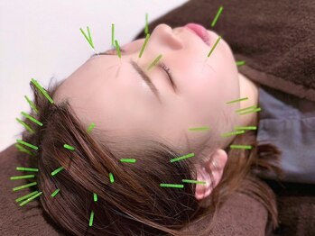 ひめじ鍼灸整骨院/ひめじ式美容鍼