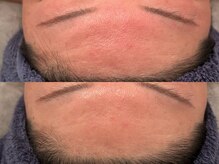 ポーデベロア(Peau des velours)/ハイピールイントゥ