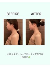 ココ 広島店(COCO)/20代　お顔二の腕スッキリ！