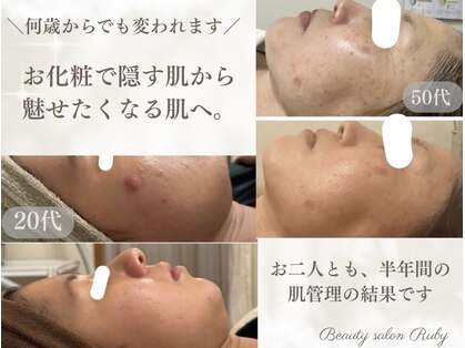 ルビー(Ruby)の写真