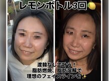 サロン ド ジジ(SALON DE GiGi)の雰囲気（『ただ減らすではなく、健康的に美しく整える』小顔コルギ×導入）