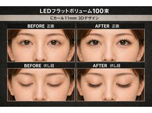 チック(chick)/LEDフラットボリューム100束