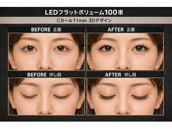 チック(chick)/LEDフラットボリューム100束