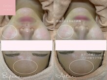 ミュー 名駅店(mieux)/お客様Before/After