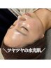 【人気No.1】美肌陶肌トリートメント♪ハーブピーリング　11,000円→9,900円