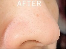 ニコリ(NICOLI)/結果重視