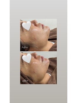 スマイルネイル(SMILE NAIL)/