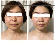 スリーピングビューティー(Sleeping Beauty)/