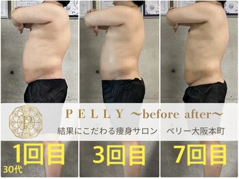ペリー(PELLY)/男性30代　before after