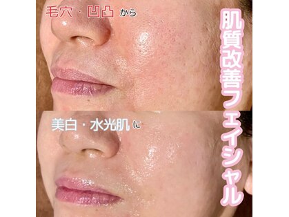 カルナ(CARNA)の写真