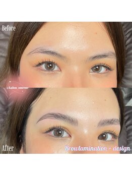 カロン(Kalon)/ブロウリフト+ワックス脱毛