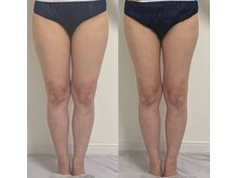 プリマルーチェ/プレミアム下半身プログラム