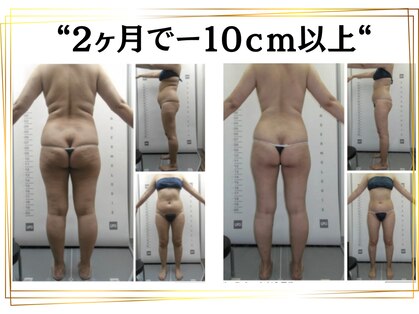 スパイア(SPIRE)の写真