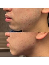 フェリーバ(FELIVA)/Before&After