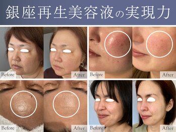 楚々(SOSO)の写真/【初回9,800円】再生美容体験 NMN×エクソソーム導入（部分導入）【契約・勧誘・販売なし】