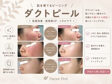 シュシュ(chouchou)