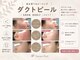 シュシュ(chouchou)の写真