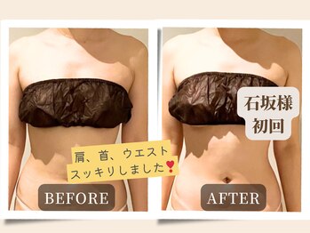 ビューティーサロンエー 心斎橋店(Beauty Salon A)/筋膜をリリースして全身スッキリ