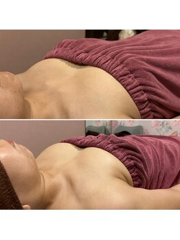 アンベリール(Embellir)/ボンボンバスト