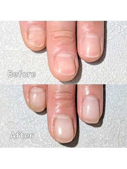 自爪育成４カ月後　初回￥5,800