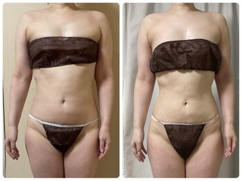 スリーピングビューティー(Sleeping Beauty)/