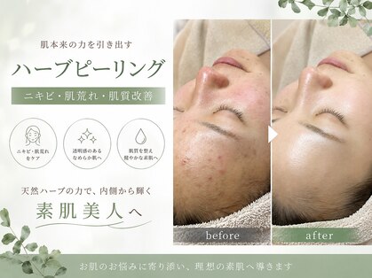 モンレーヴ(MonReve)の写真
