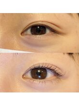 ネイルアンドアイ ビューティーオーブ(nail&eye beauty ORB)/上下まつ毛パーマ