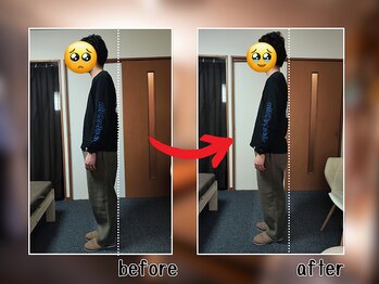 セレナ 川越/骨盤矯正と全身施術で姿勢改善!