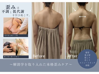ルノン(Lunon)の写真