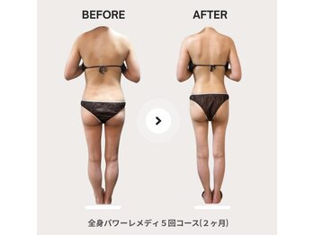 ビループ(biloop)/今年中に変わりたい方はbiloopへ