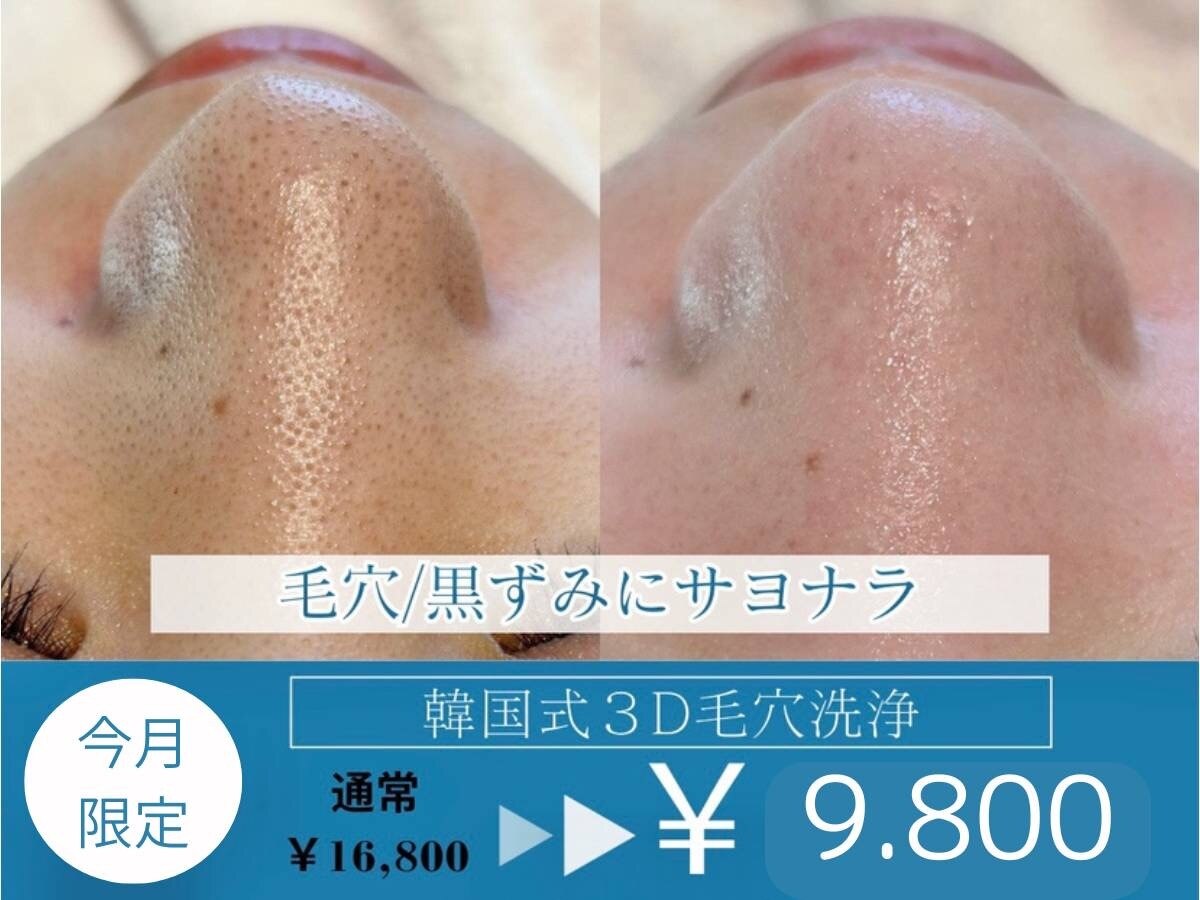 ラデュープラス(Radieux+)｜ホットペッパービューティー