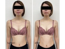 ワム(Wom)/ウエストほっそり/谷間くっきり