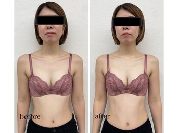 ワム(Wom)/ウエストほっそり/谷間くっきり