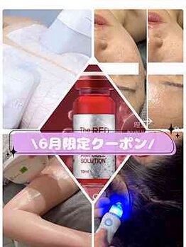 ナーズプラス リベルテ(Naz Plus/Liberte)の写真/6月限定クーポン！！悩みに合わせて選べる3つのクーポンでお得にケアできます☆