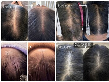 シンデレラ(Cinderella)