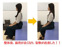 やぎはし整体院 柏駅東口店/姿勢ビフォーアフター