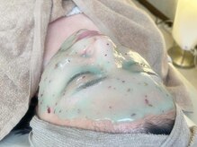 リエラ(Riela)/◇施術イメージ◇