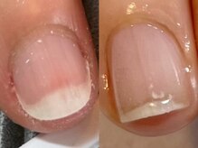 エマネイル(emma nail)/うっとり眺めたくなる美爪に！