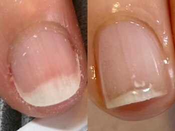 エマネイル(emma nail)/うっとり眺めたくなる美爪に！