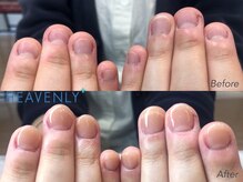 ヘブンリープラス＋ Luz湘南辻堂店/深爪矯正 自爪育成 ネイルケア