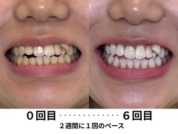 ハロ(halo)/【岩手県/矢巾/紫波/盛岡/花巻】