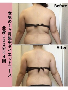 タノソイネ(tanosoine)/【全身/ハイパーナイフ痩身】