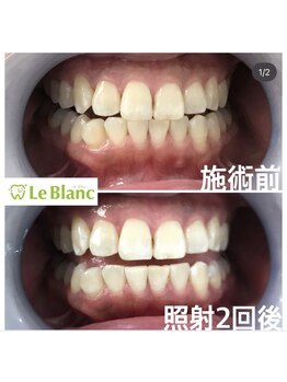 ルブラン 奈良店(Le Blanc)/笑顔に自信を