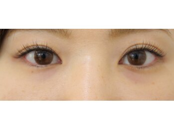 ビームズ トータルビューティー 西中島店(BeeMs Total Beauty)/【キュート】シングル120本