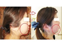 サロンドエステケイワイ(de KY)/フェイシャル☆小顔・タルミ改善