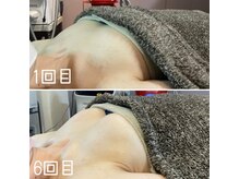 ガーデン(Garden)/バストケア