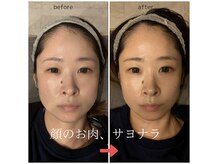 トリニティスペース(TrinitySpace)の雰囲気（プラズマ＆脂肪分解で驚きの小顔美肌！口コミを参考に☆）