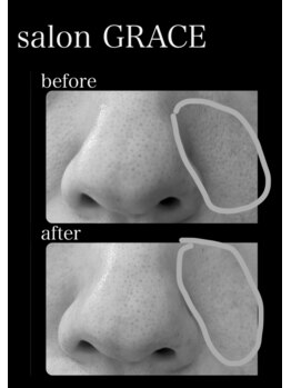 サロン グレイス(salon GRACE)/