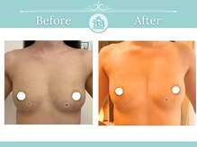 美人バスト 浜松店/◇ バストアップ &nbsp;BeforeAfter◇